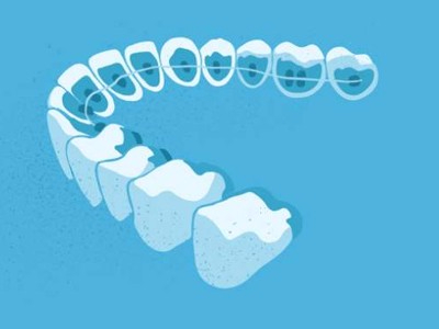 惟德口腔醫(yī)院口腔正畸好不好？